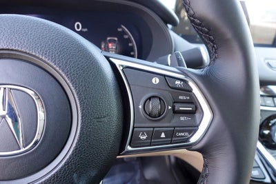 2025 Acura TLX Technology Package