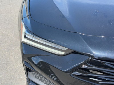 2025 Acura TLX Technology Package
