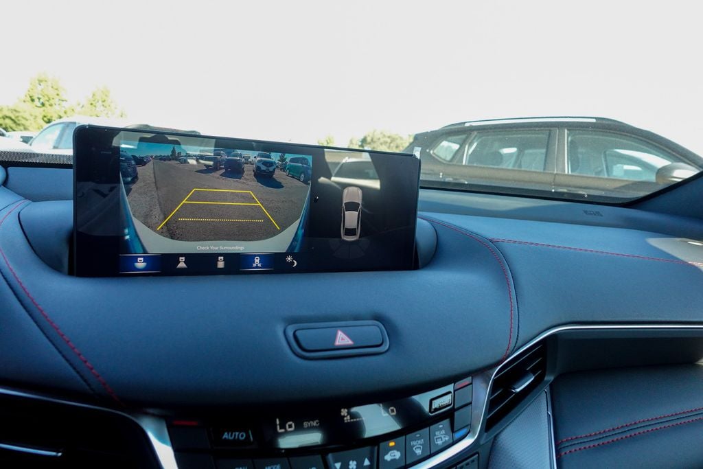 2025 Acura TLX A-Spec Package SH-AWD