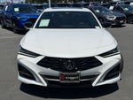 2025 Acura TLX A-Spec Package SH-AWD